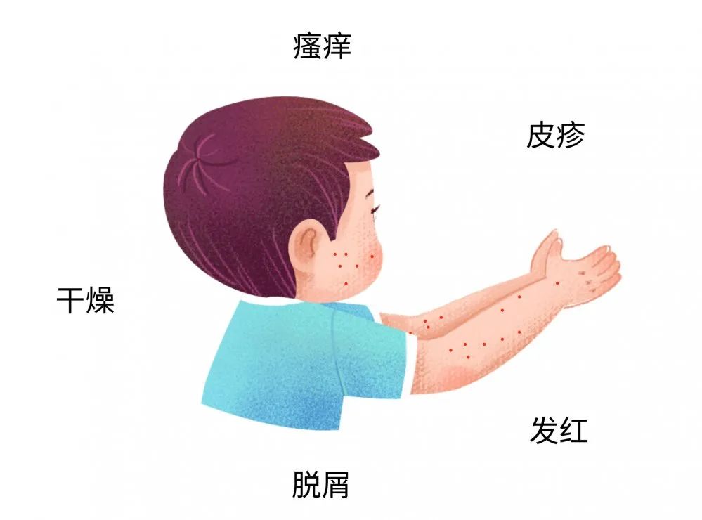 这些症状都可能是宝宝过敏传递的信号，，很多宝妈还不知道